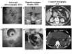 Figure 7. . Most commonly used imaging procedures in MEN1 syndrome clinical diagnosis.