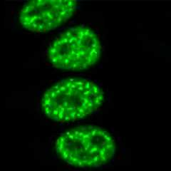 antinuclear antibodies (ANA)