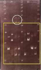 飯塚事件で、科警研が1992年に行ったMCT118法による鑑定写真ネガフィルムのデータ。左右両端と中央は型を測る物差しに当たるマーカー(旧型)。その他が、被害者に付着していた血痕や心臓血など8種類の試料から検出された型。型を示すバンドは幅広で、「鬼の面」のように両端が流れている。確定審では四角い枠内の現像写真のみ証拠採用されたが、再審請求後に弁護団の求めでこのネガデータが開示された。弁護団は○で囲む部分に「真犯人の型が写っている。科警研が意図的に隠した」と主張する。 (弁護団提供)