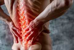 Image of back and spine
