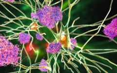 Neurons with Alzheimer's disease