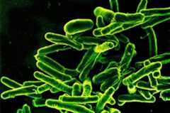 Scanning electron micrograph of Mycobacterium tuberculosis bacteria, which cause TB.
