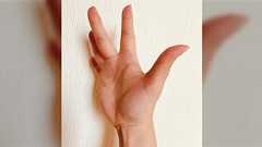 漫画で描かれる手首の線(長掌筋)はある人と無い人がいるらしい「現代において不要な部位の一つ」