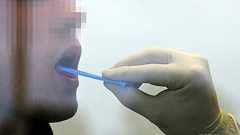 燃え尽き症候群、簡単な唾液テストで判定可能 研究