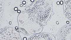 寄生虫「エキノコックス」、愛知県で犬の感染相次ぐ 人体に入ると重い肝機能障害 | 社会 | 全国のニュース | 福井新聞ONLINE