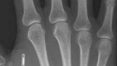 カスペルスキー、社員にマイクロチップを埋め込む。 - すまほん!!