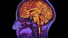 「認知症の約45%はこれで予防できる」最新の大規模研究で判明した認知症予防に効く日常習慣と最強食材 60~79歳2000人以上を2年間にわたって追跡調査