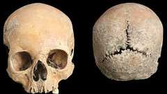 九世紀頃のアングロ・サクソン少女の頭蓋骨、皮剥ぎ・鼻削ぎ刑が加えられていたことが判明 | Call of History ー歴史の呼び声ー