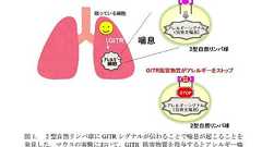 東北大、気管支ぜんそく発症の原因を明らかに アレルギー疾患の新治療法開発へ