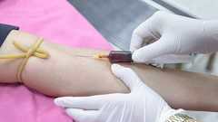 「若者の血」を輸血して若返るためのクリニックがニューヨークに開設予定