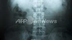 直腸に携帯電話隠した受刑者、着信音でばれる