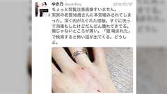 猫に咬まれて『パスツレラ症』になってしまった人の体験談が怖すぎる「そんなにヤバイのか」