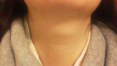 『喉の異変 その2 診断』