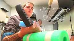 脳にチップを埋め込んで四肢麻痺の人が腕を動かすことに成功した「神経バイパス」とは?