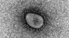 「オミクロン株」京都で新たに4人感染 中等症1人、ワクチン2回接種済み |医療・コロナ|地域のニュース|京都新聞