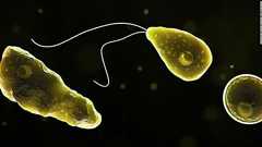 「脳をむしばむアメーバ」に感染した住民死亡、水道水で鼻洗浄か 米フロリダ州