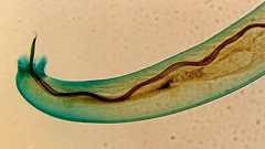 人間の脳に寄生する寄生虫の存在をハワイ保健局が旅行者に警告