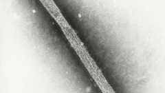 米、鳥インフルエンザ感染3人目 牛からヒトに