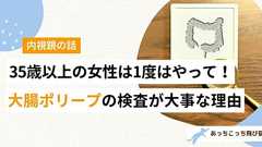 大腸ポリープの検査が35歳以上の女性にはとても大切な理由