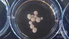 実験室で培養の「ミニ脳」に神経活動、人の脳に類似 米研究