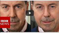 生きた皮膚を3D印刷 「シワはプリンターで除去」する未来 | Forbes JAPAN 公式サイト(フォーブス ジャパン)