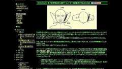 「携帯電話が心臓ペースメーカーを誤動作させる」という話 - ガジェット通信