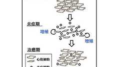 心筋に秘められた再生能力を発見 大阪大グループ | Science Portal - 科学技術の最新情報サイト「サイエンスポータル」