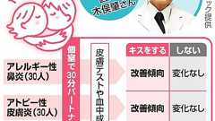 アトピーにはキスが効果的? イグ・ノーベル賞に日本人:朝日新聞デジタル