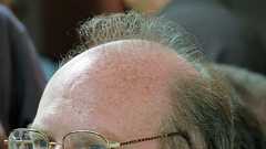 「ハゲていると新型コロナウイルス感染症が重症化する」という可能性