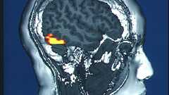 相貌失認 - Wikipedia