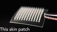 肌に貼るだけで肥満を治療できるパッチが開発される