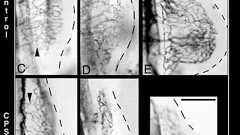 サリドマイドで手足の奇形が生じるメカニズム | 5号館を出て