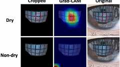 「瞳に映るモニター画面」でドライアイ検出 東大が深層学習で開発