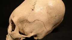 かつて世界各地で行われた人工頭蓋変形、その歴史と意義 | カラパイア