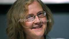 ノーベル医学賞、寿命をつかさどるテロメアとテロメラーゼ酵素とは?