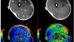 わずか40秒の運動で身体に起こる劇的変化 – 早稲田大学 研究活動