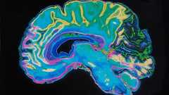 脳に"寄生虫"が棲むヒトが「3人に1人」いる…感染者は起業家になる割合が高いと言われる意外すぎる背景 感染したオオカミが群れのリーダーになる確率は非感染の個体の「46倍以上」