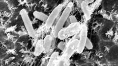 ペットボトルを食べる細菌発見 「分解できぬ」定説覆す:朝日新聞デジタル