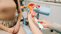 Eine Ärztin hält das Modell einer Gebärmutter mit eingelegter Spirale. Daneben sitzt eine Patientin, symbolisch für Kupferspirale.