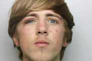 thug shoved thumbs ex girlfriends eyes