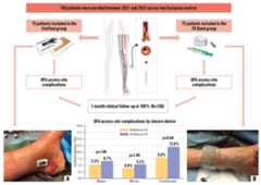 DFA access compression in lower limb angioplasty