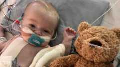 Chester, a baby boy, lies in a hospital bed next to his teddy. He has a bandage on his chest and some tubes attached to his nose.