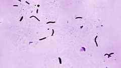Die US-Gesundheitsbehörde CDC stellte dieses Mikroskopfoto von 1966 bereit. Es zeigt Bazillen von Mycobacterium tuberculosis. Sie verursachen Tuberkulose.