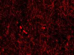 Lymphatic-like structures within the brain of a healthy person