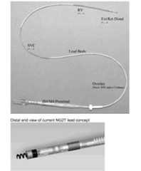 Figure US20070276458A1-20071129-P00001