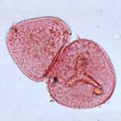 A magnified bracken spore