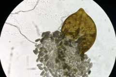 A microscope close up shows a yellow soybean cyst releasing small nematode eggs