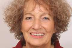 02-Teaser_Testimonials_barten